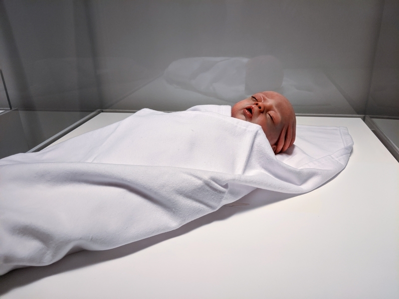 新生児に対する外科手術の倫理を問う作品「変容」by Agi Haines